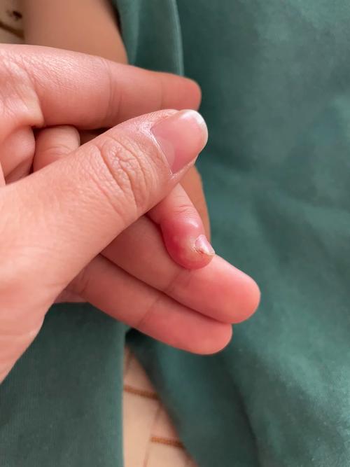 宝宝才两根手指就流了，这款产品你绝对值得拥有